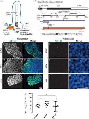 Induction of Neural Crest Stem Cells From Bardet–Biedl Syndrome Patient Derived hiPSCs